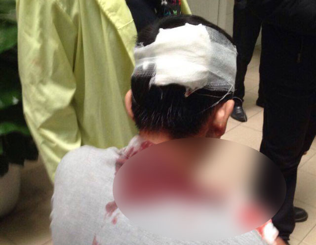 Hải Phòng: Bảo vệ bệnh viện Việt Tiệp vụt vào đầu người nhà bệnh nhân
