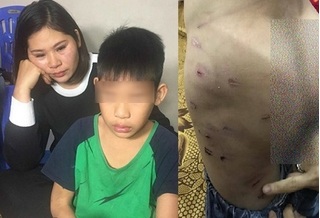 Mẹ bé trai 9 tuổi bị bố bạo hành dã man ở Hà Nội ký đơn hòa giải