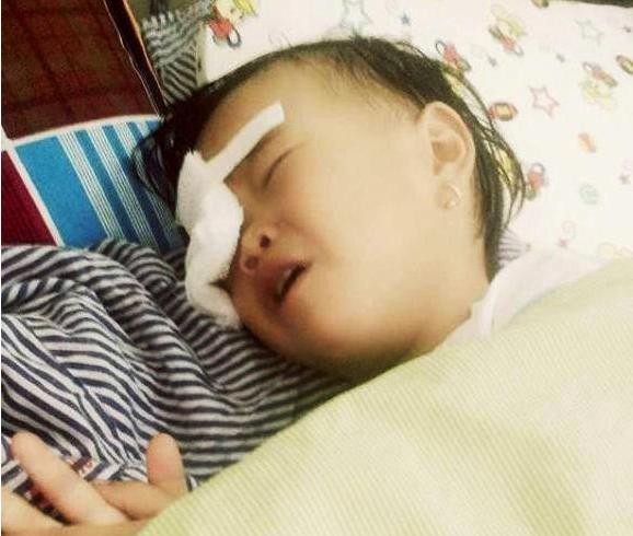 Nghệ An: Bé gái 2 tuổi bị gà chọi đá vào mắt