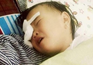 Nghệ An: Bé gái 2 tuổi bị gà chọi đá vào mắt phải nhập viện khẩn cấp