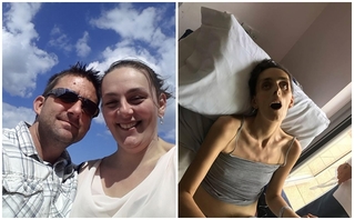 Chồng đau đớn chia sẻ bức ảnh gây sốc của vợ trên giường bệnh