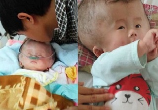 Rơi nước mắt với bé 9 tháng bị não úng thủy đang giành giật sự sống