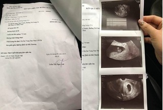 Thai phụ tố bệnh viện yêu cầu hút thai khi thai nhi vẫn bình thường
