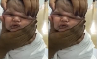 Làm bẹp mặt bé sơ sinh, nhóm y tá gây phẫn nộ đã bị sa thải