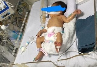 Bé gái 32 tuần tuổi nghi bị mẹ đẻ đặt thuốc ép cho chết để sinh non