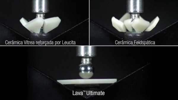 Công nghệ bọc răng sứ Lava 3M