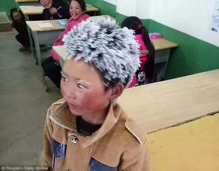 Cậu bé nghèo tóc đóng băng được ủng hộ hàng trăm nghìn USD