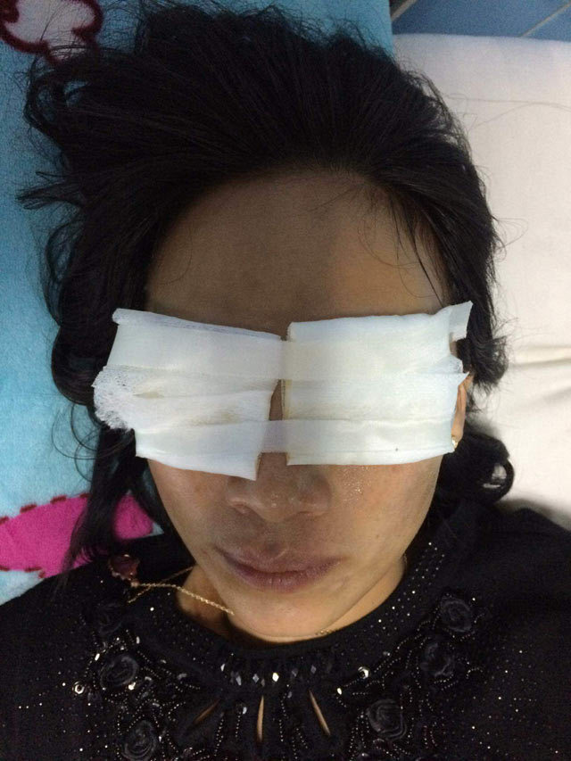 Quảng Bình, mẹ chồng tạt ca axit vào người con dâu chết tại nhà