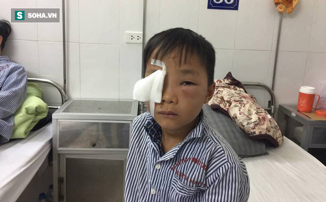 bé trai bị chó cắn thủng mắt
