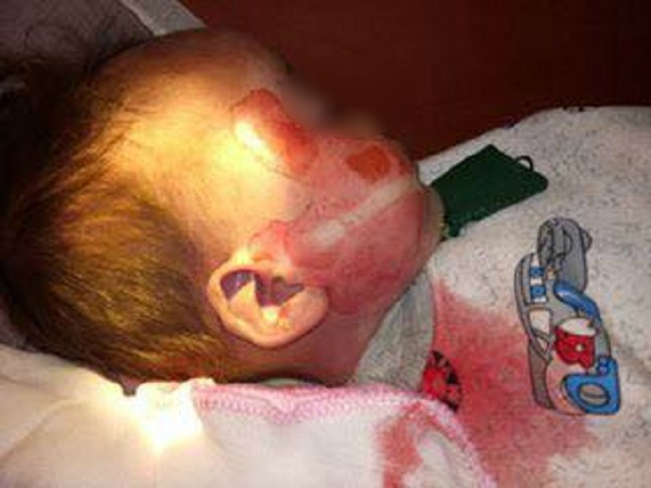 Vụ bé 15 tháng tuổi tử vong với nhiều vết thương lạ ở Thanh Hóa, bệnh viện khẳng định không làm rơi cháu bé.
