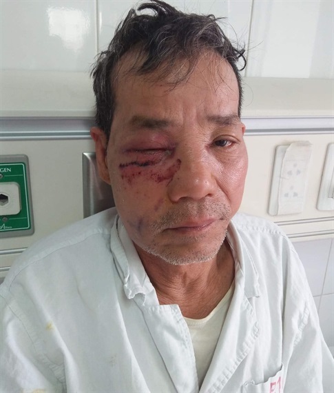 Tuyên Quang: Lâm tặc ném đá khiến 1 kiểm lâm bị thương nặng