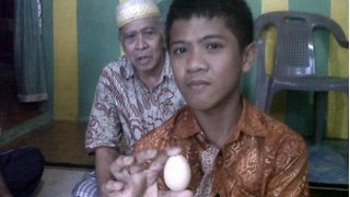 Indonesia: Người đẻ ra trứng khiến giới y khoa xôn xao