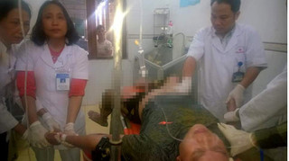 Hạ cây nêu ngày Tết, hai anh em bị điện giật nguy kịch