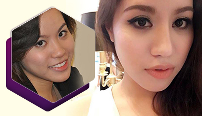 Công nghệ mở góc mắt Pearl Eyes 