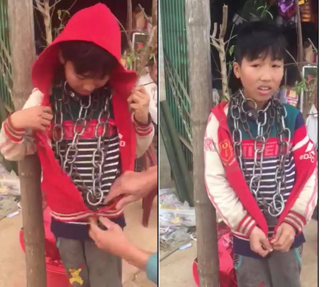 Phạt cảnh cáo người chú xích cổ bé trai bị quấn xích quanh cổ ở Thanh Hóa