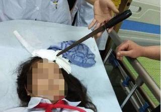 Hà Nam: Nữ sinh 14 tuổi bị bạn cùng lớp phi dao cắm vào trán