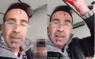 Phẫn nộ gã đàn ông máu lạnh đâm chết vợ rồi thản nhiên livestream trên Facebook