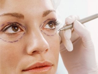 Phẫu thuật thẩm mỹ mắt lồi trả lại vẻ cuốn hút cho đôi mắt
