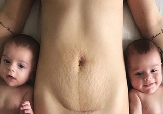 Không buồn, không tủi, đây là cách bà mẹ hai con nghĩ về vết bụng rạn sau sinh