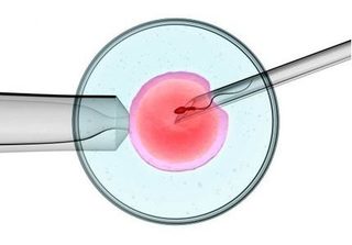 Kỹ thuật tiêm tinh trùng vào bào tương trứng (ICSI) trong điều trị vô sinh, hiếm muộn có gì đặc biệt?