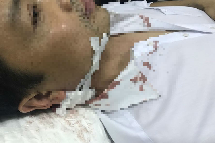 Hải Phòng: CSGT bị người vi phạm dùng dao bầu đâm trúng gáy