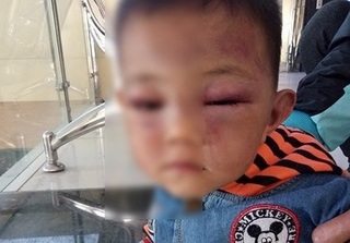 Cha dượng bạo hành bé trai 2 tuổi: Phẫn nộ về lời khai của người cha tàn độc 