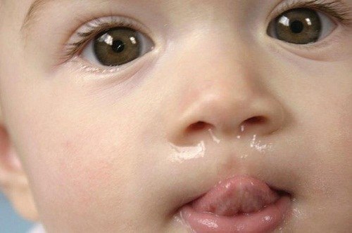 Bài thuốc đơn giản giúp bé yêu dứt cơn sổ mũi chỉ trong 3 ngày