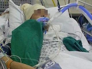 Bỏ qua dấu hiệu nhức đầu, chàng trai trả giá bằng cả tính mạng vì viêm não cấp tính