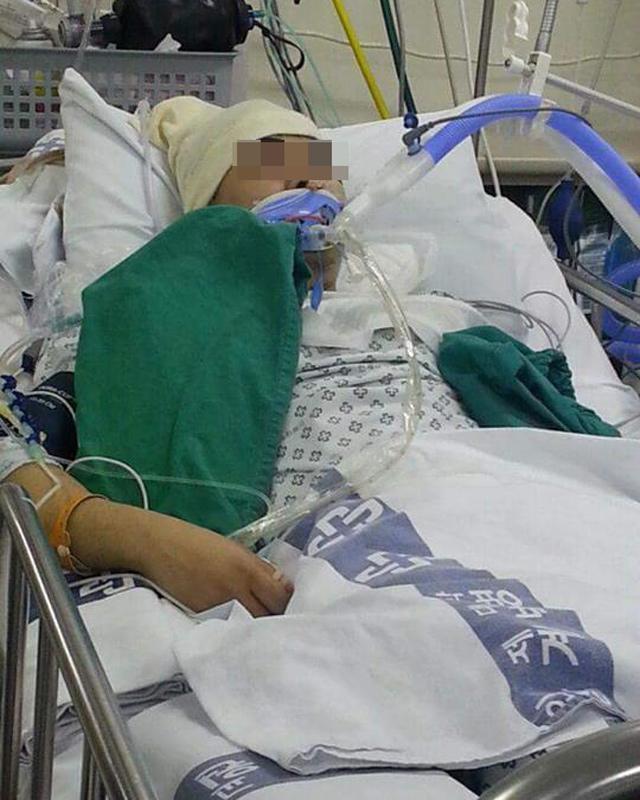 Bỏ qua dấu hiệu nhức đầu, chàng trai trả giá bằng cả tính mạng vì viêm não cấp tính