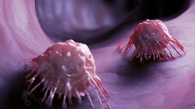 cà tím phòng ung thư mỡ máu