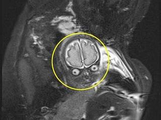 Nhìn ảnh chụp MRI của vợ bầu, ông chồng thốt lên: 