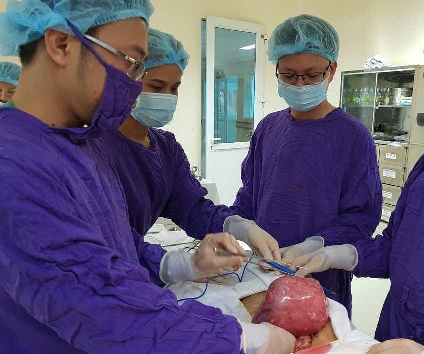 khối u xơ tử cung to bằng một em bé sơ sinh được phẫu thuật cắt bỏ
