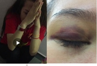 Bị bạn trai ngoại quốc bạo hành, tung clip 'nóng' lên mạng, cô gái cầu cứu công an