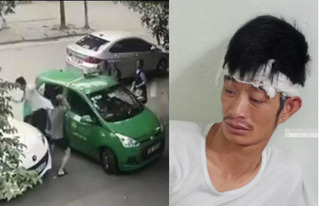 Chuyển tài xế taxi Mai Linh bị chủ xe Mercedes đánh sang BV Việt Đức để điều trị