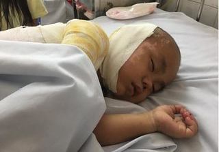 Lào Cai: Bố đốt tro lấy than, con trai 4 tuổi ngã vào bị bỏng nặng