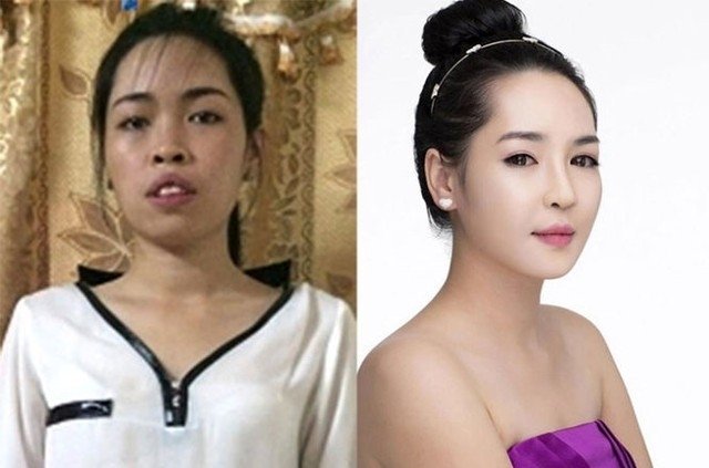 Cô gái Nam Định đập mặt làm lại ngày càng xinh đẹp và quyến rũ1