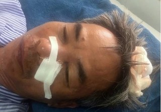 Quảng Ninh: Khởi tố, bắt tạm giam đối tượng hành hung khiến 3 người nhập viện