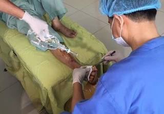 Chủ quan với mụn nước nhỏ, bệnh nhân đái tháo đường phải tháo khớp ngón chân