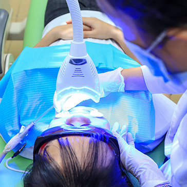 Công nghệ tẩy trắng răng bằng Laser