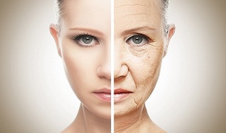 Hai phương pháp căng da mặt hiện đại để luôn tươi trẻ