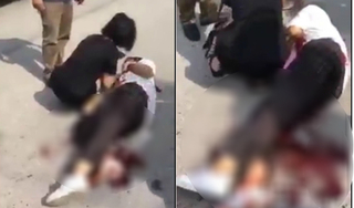 Bắc Giang: Hai nữ sinh ẩu đả, một người bị đâm trọng thương
