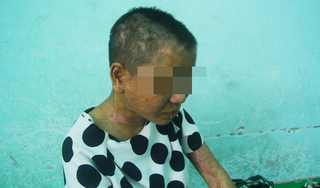 Vụ tra tấn người làm ở Gia Lai: Nghi phạm thừa nhận chặt đứt ngón tay nạn nhân