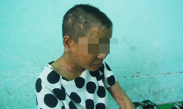 Vụ tra tấn người làm ở Gia Lai: Nghi phạm thừa nhận chặt đứt ngón tay 