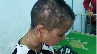 Triệu tập 5 người liên quan đến vụ tra tấn cô gái trẻ dã man ở Gia Lai