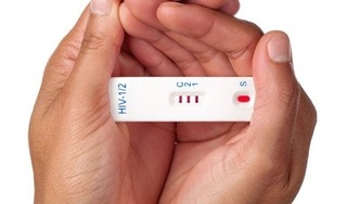 Những dấu hiệu sớm nhận biết một người bị nhiễm HIV