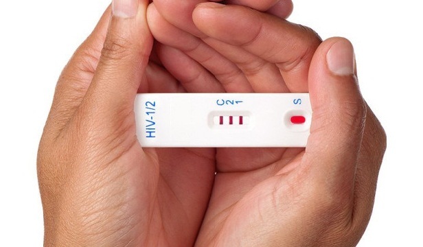 Những dấu hiệu sớm nhận biết một người bị nhiễm HIV2