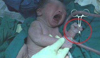 Vừa chào đời, bé sơ sinh đã 'chộp' ngay cây kéo của bác sĩ khiến dân mạng 'mắt tròn mắt dẹt'