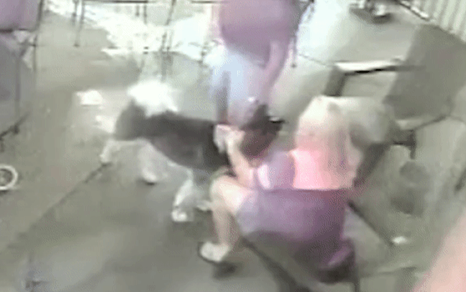 Người phụ nữ bị cắn nát mặt vì trót âu yếm chó lạ bên đường