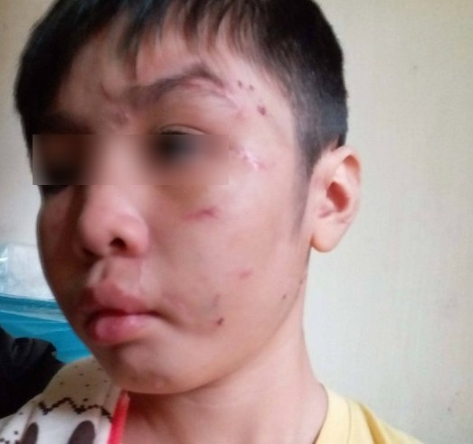 Chuẩn bị xét xử vụ bố đẻ cùng mẹ kế bạo hành con trai 10 tuổi ở Hà Nội