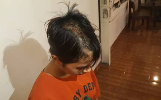 Thiếu nữ 14 tuổi bất ngờ bị nhóm thanh niên đánh trọng thương trên đường